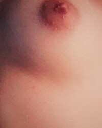 photo-thumb