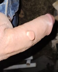 photo-thumb